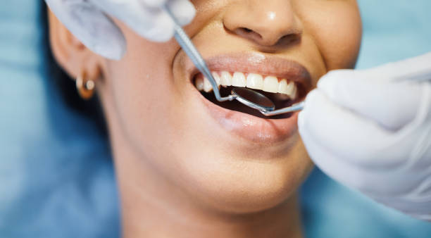 Best After-Hours Emergency Dentist in Fitzgerald, GA
